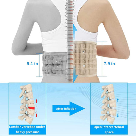 Lumbar RX